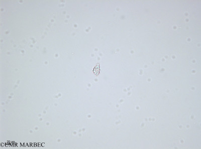 phyto/Bizerte/bizerte_bay/RISCO April 2014/Protoperidinium bipes (- 140728_001_ovl-2).tif(copy)_thumb.jpg